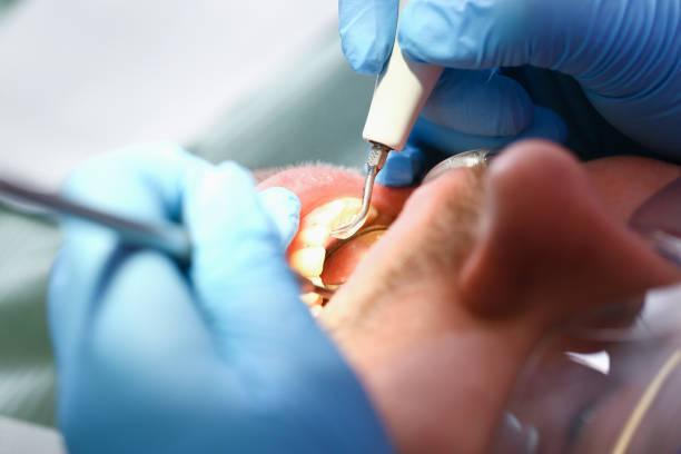 Best Emergency Treatment for Toothache in George, IA