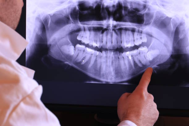 Best Emergency Dental Surgery in George, IA