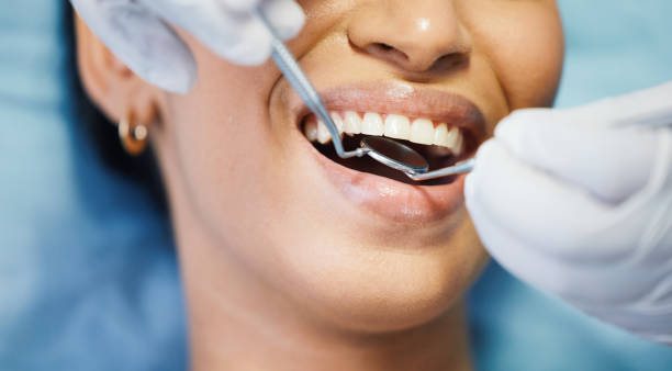 Best Emergency Wisdom Teeth Removal in George, IA